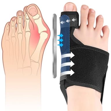 Correcteur Hallux Valgus, Réutilisable Redresseur Orteil Antidérapant, Réglable Nuit & Jour Ecarteur D'orteil Oignon, Séparateurs D'orteils Avec, Pour hallux valgus Bunion Femmes et Hommes(Droite)
