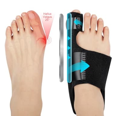 ACWOO Correcteur Hallux Valgus, Réglable Redresseur Orteil Utiliser Jour et Nuit, 2 x Ecarteur d'orteil Oignon 2 x Correcteur Silicone, Kit Oignon Pied Correcteur de Oignon pour Femmes et Hommes